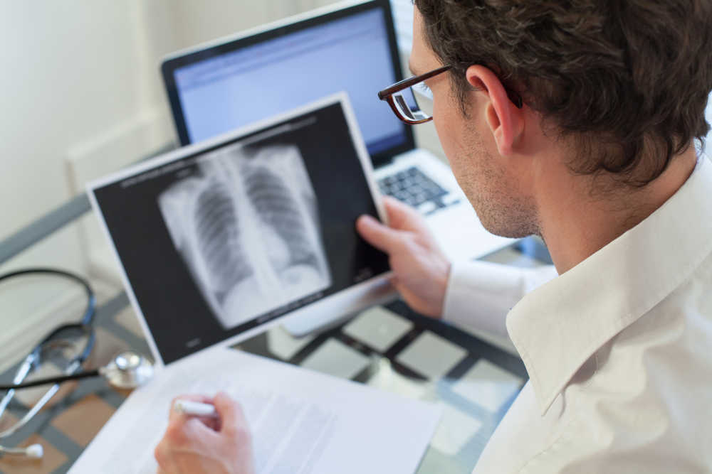 ¿Qué debemos saber acerca de los nódulos pulmonares?